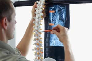 Most Common Spine Injuries from Car Accidents