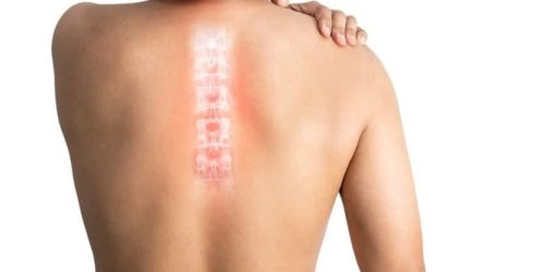 5 Signs of a Spinal Cord Injury Following an Accident