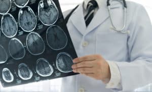 Top 5 Diseases That Cause Neurological Pain